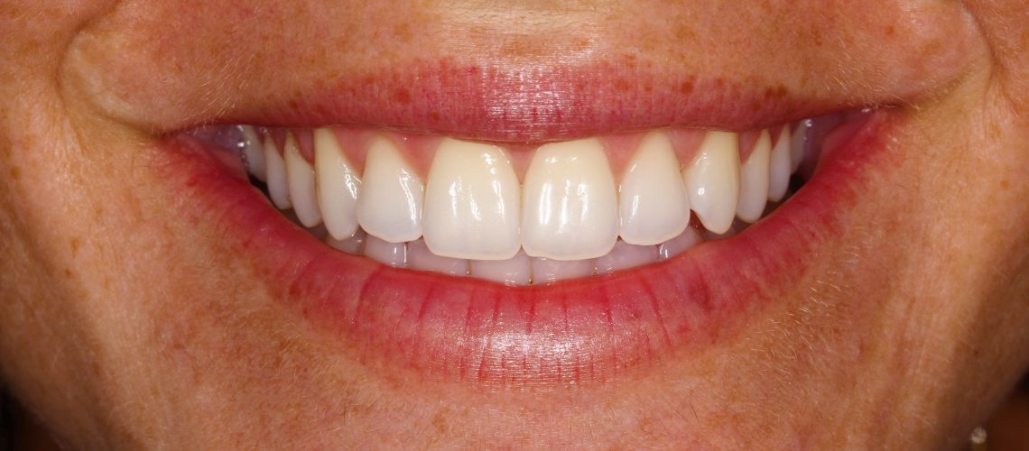 ESTÉTICA 3